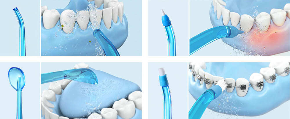 Xiaomi Soocas W3 Pro Blue-3.jpg