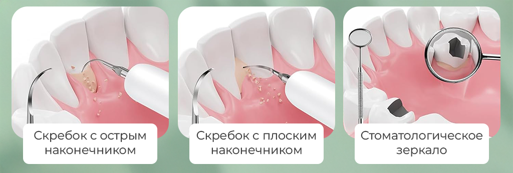 SenCiciMen Electric Teeth Cleaner (SCMT4)-рич-4.png