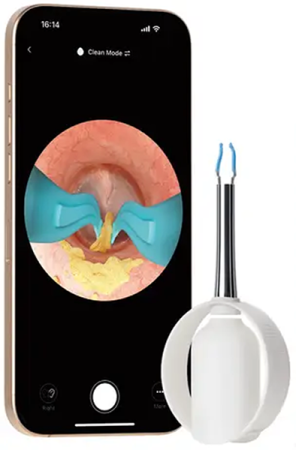 Купить Xiaomi Bebird Smart Visual Ear Cleaner EarSight Plus R37R White